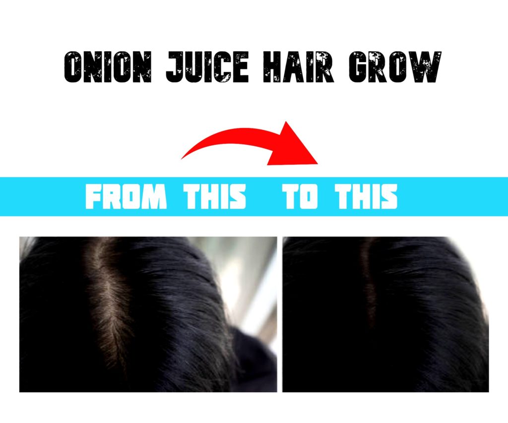 onion-juice-hair-grow