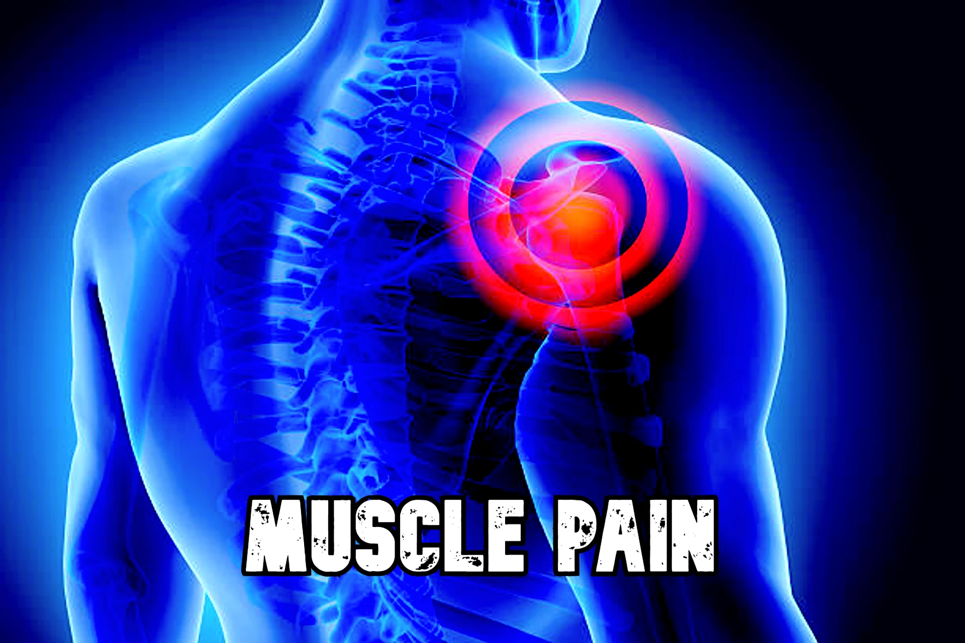 Natural Remedies for Muscle Pain_health-issue